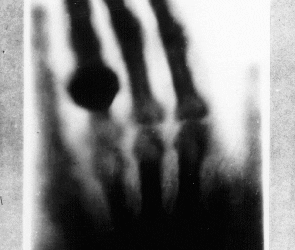 Les Tècniques Radiogràfiques Aplicades A L’Estudi I Diagnòstic De L’Estat De Conservació Dels Béns Culturals